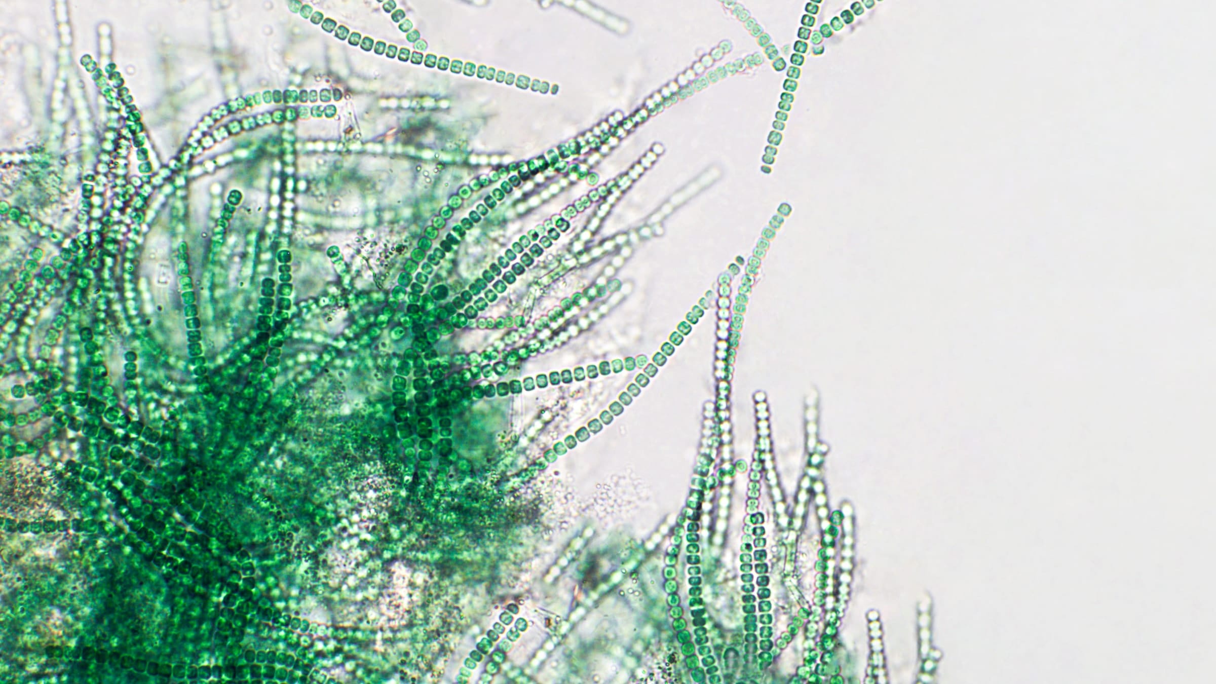 Green bacteria under a microscope